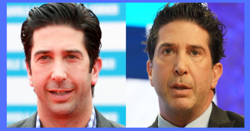 David Schwimmer Plastic Surgery
