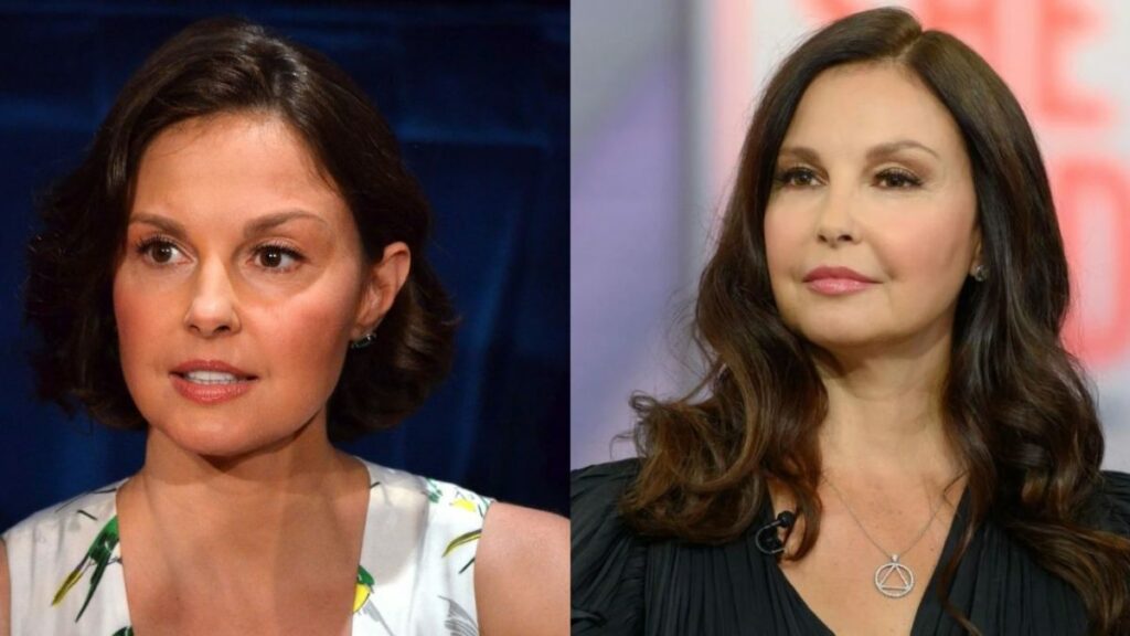 Ashley Judd’s Plastic Surgery