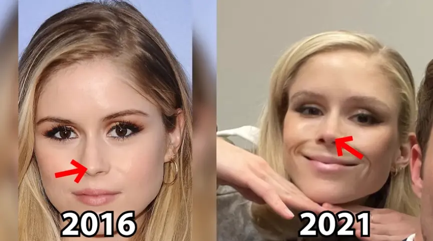 Erin Moriarty plastic surgery