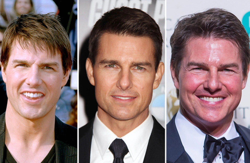 Truth Behind Tom Cruise Plastic Surgery