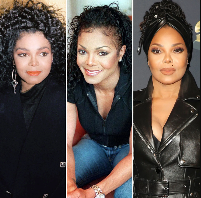 Janet Jackson plastic surgery