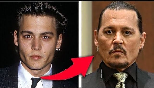 Johnny Depp Plastic Surgery