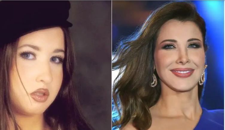 Nancy Ajram Plastic Surgery Before And After