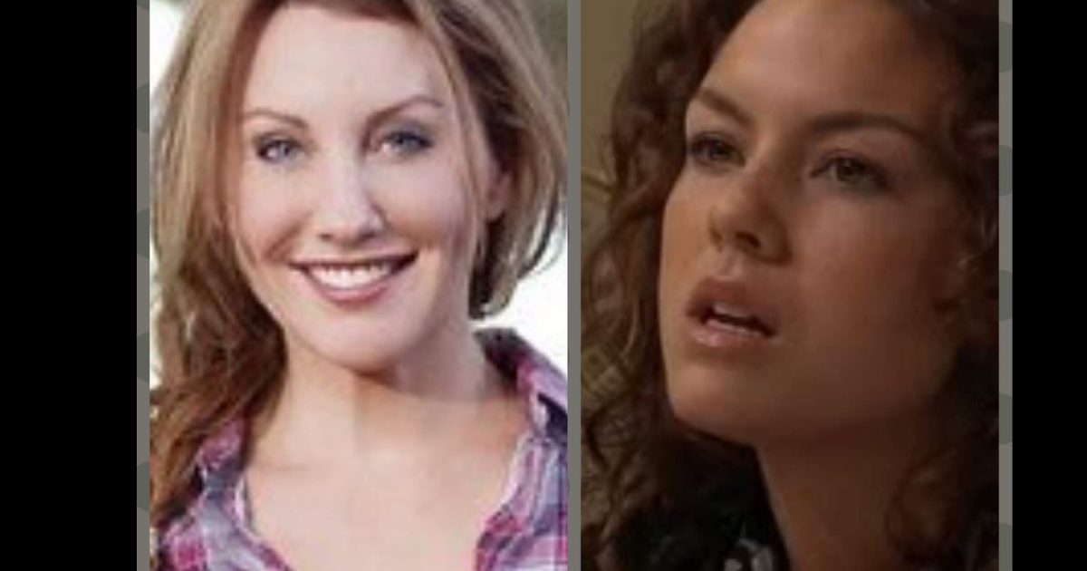 Amy Matthews Plastic Surgery