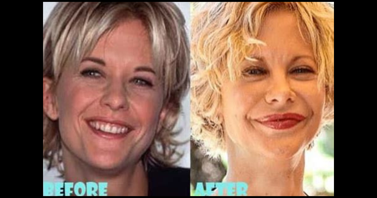 Amy Matthews Plastic Surgery