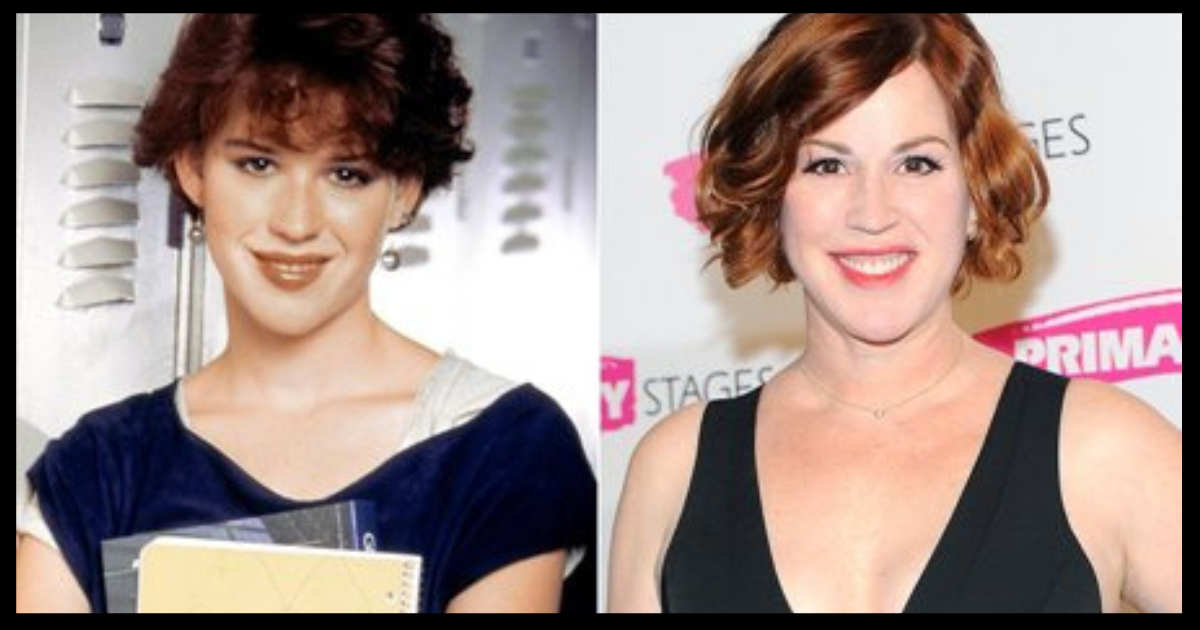 Molly Ringwald Plastic Surgery