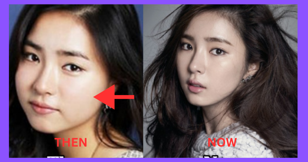 Shin Se-kyung Plastic Surgery