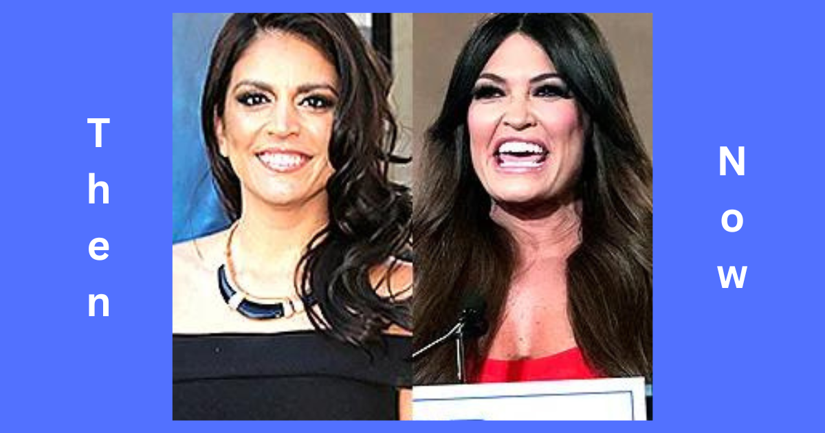 Cecily Strong Plastic Surgery