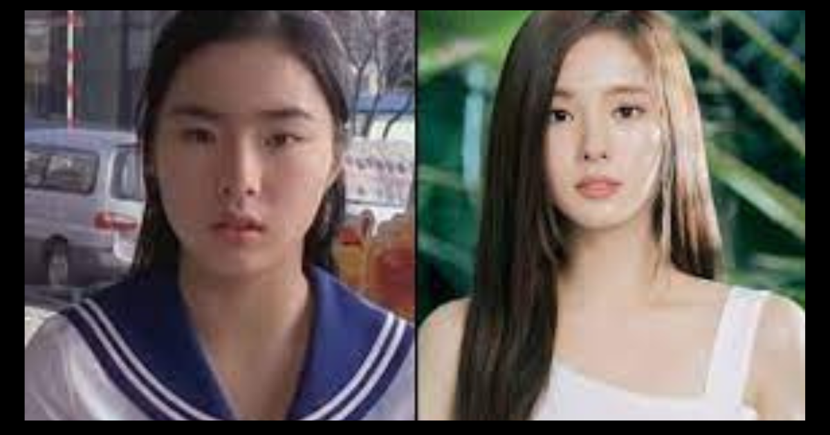Shin Se-kyung Plastic Surgery