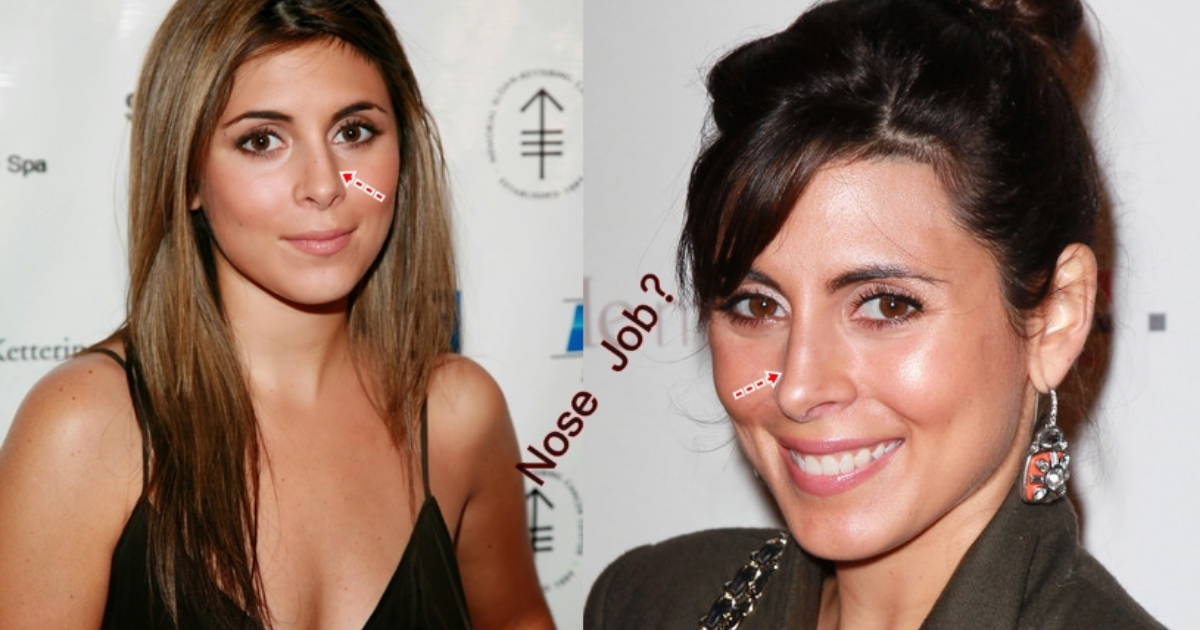 Jamie-Lynn Sigler Plastic Surgery